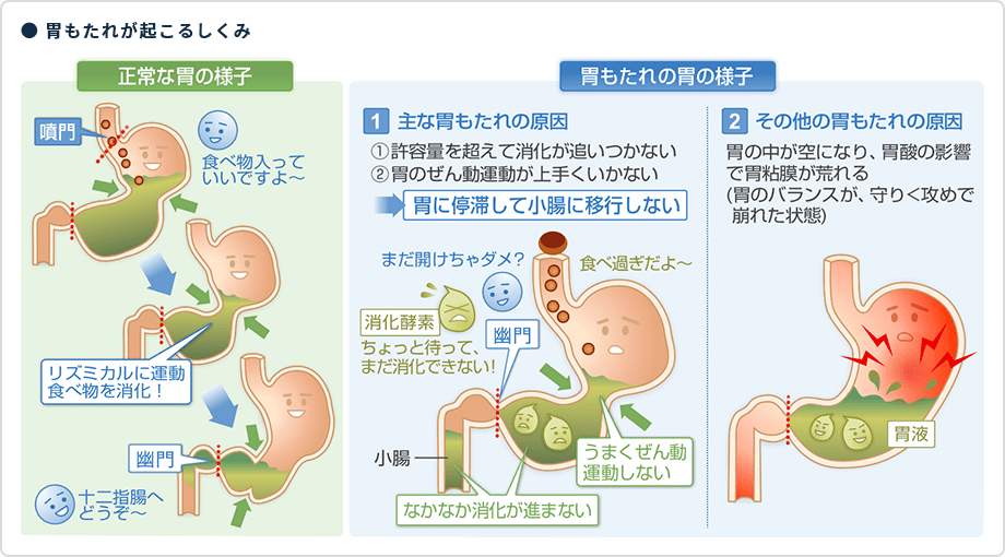 ● 胃もたれが起こるしくみ