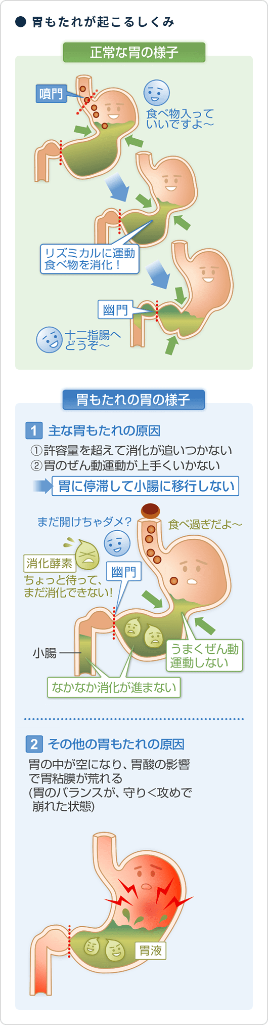 胃 もたれ 直し 方