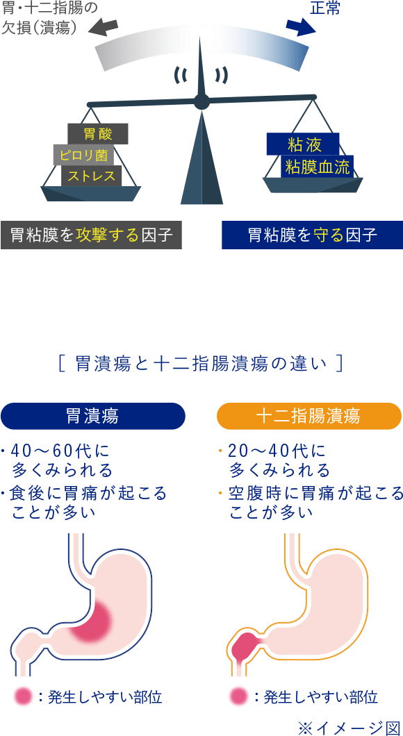 みぞおち の 痛み