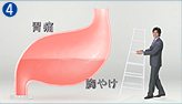 60bp@4