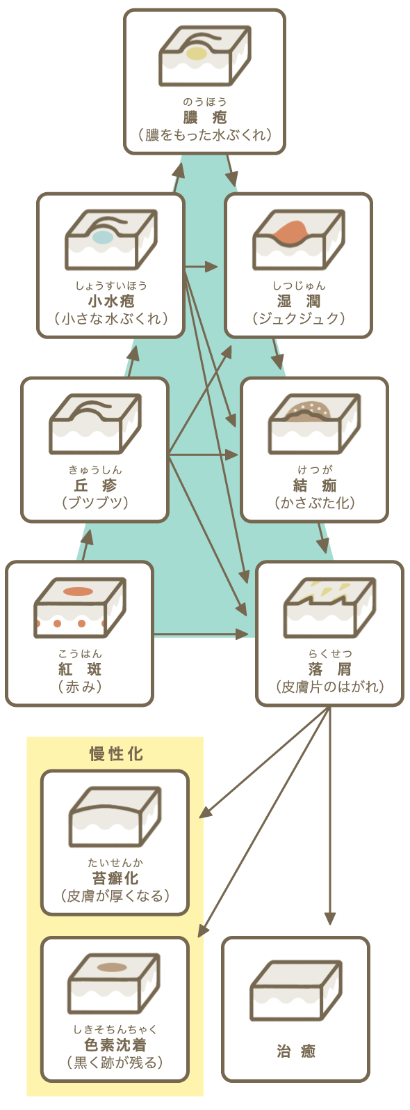 湿疹三角形のイラスト