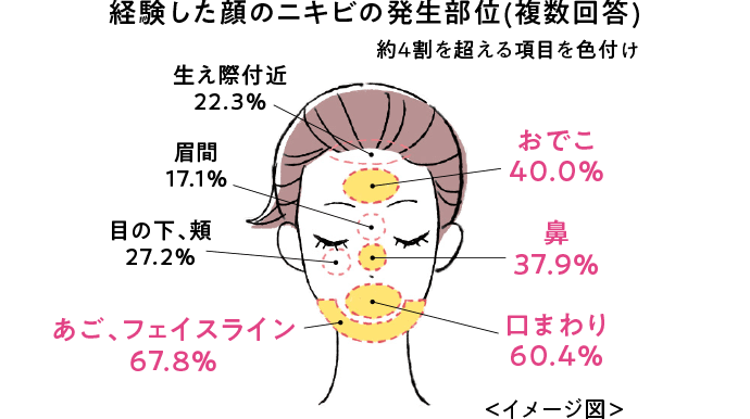 ニキビの基礎知識とケア方法 マキロン アクネージュ 第一三共ヘルスケア