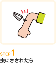 STEP1.虫にさされたら