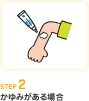 STEP2.かゆみがある場合