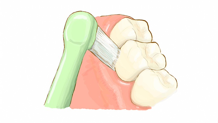 ブラシの毛先が斜め45度で歯肉にあたっているイラスト