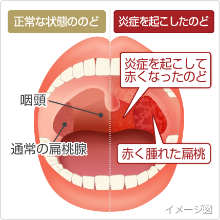 て 歯 薬効 寝れ 痛く が かない ない