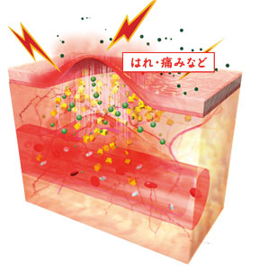 喉の痛みに効く仕組み のど 喉 の痛み 腫れを飲んで治す治療薬 ペラックt錠 第一三共ヘルスケア