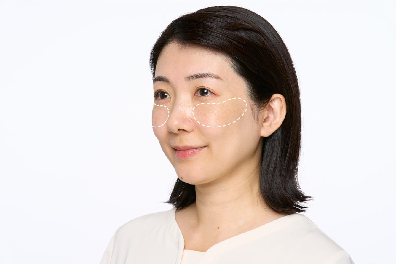 トランシーノEX｜第一三共ヘルスケア