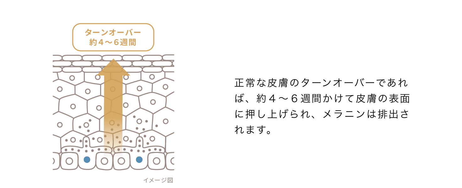 正常な皮膚のターンオーバーであれば、約４～６週間かけて皮膚の表面に押し上げあられ、メラニンは排出されます。