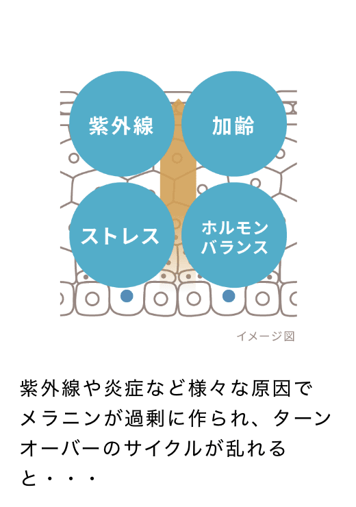 紫外線や炎症など様々な原因でメラニンが過剰に作られ、ターンオーバーのサイクルが乱れると・・