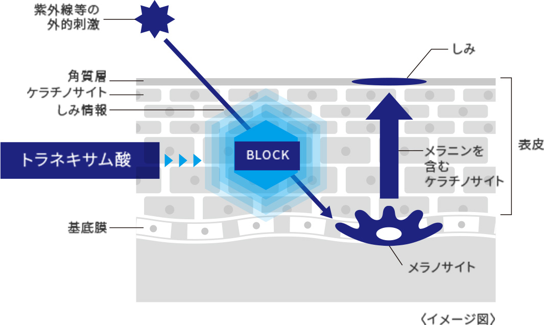 トラネキサム酸でブロック